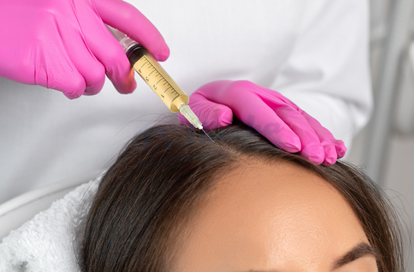 Liệu trình tiêm meso kích thích mọc tóc an toàn và hiệu quả