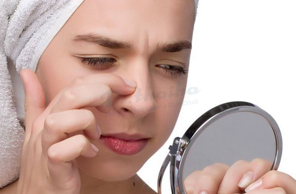 Tại sao không nên tiêm filler mũi khi không có chỉ định từ bác sĩ?