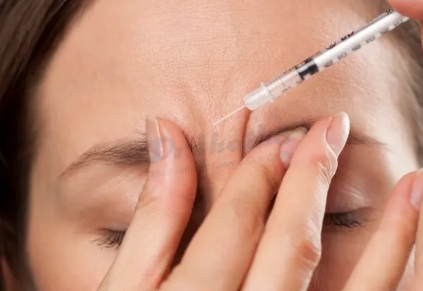 Bao nhiêu tuổi được tiêm botox? Chuyên gia chia sẻ