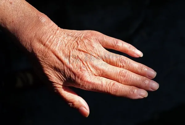 Lão hóa da tay và cách chống lão hoá da tay hiệu quả