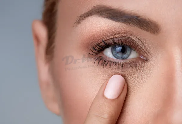 Lão hóa da vùng mắt và cách chống lão hóa da vùng mắt