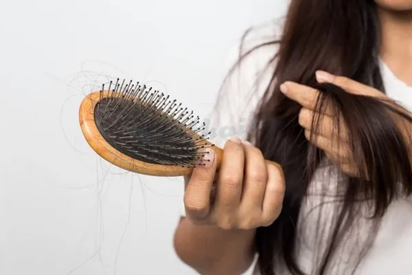 Rụng tóc thiếu chất gì? Cách điều trị rụng tóc
