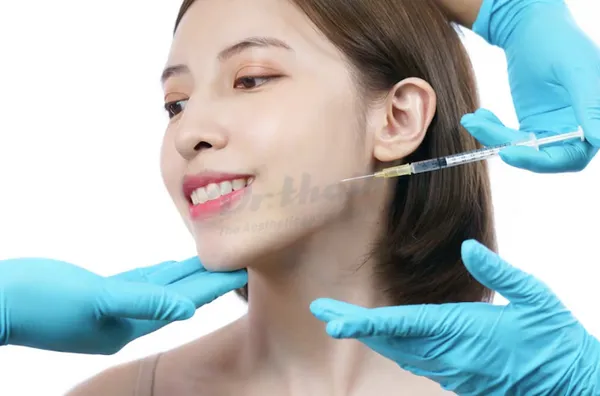 Tiêm botox hàm bao lâu hiệu quả và duy trì trong bao lâu