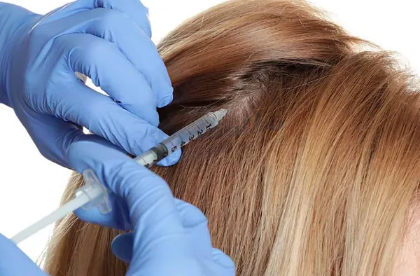 Tóc rụng sau sinh và cách điều trị bạn cần biết